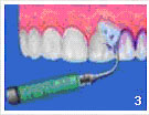 110_Чистка зубов 3.jpg